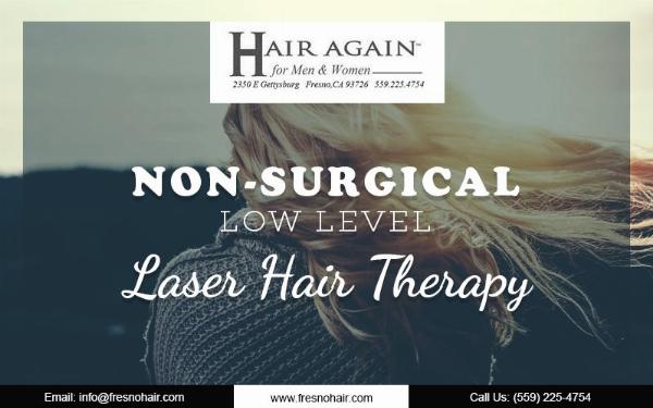 Complete Guide to Non-Surgical Hair Replacement for Men: Systems, Costs, and Care