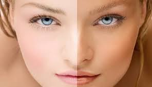 Skin Whitening in Islamabad: Understanding Risks, Regulations, and Safer Choices