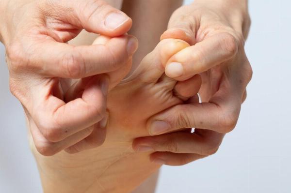 Plantar Warts Explained: Causes, Diagnosis, and Treatment Options