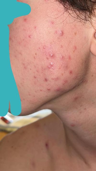 Practical Guide to Diagnosing and Treating Skin Disorders in Dubai