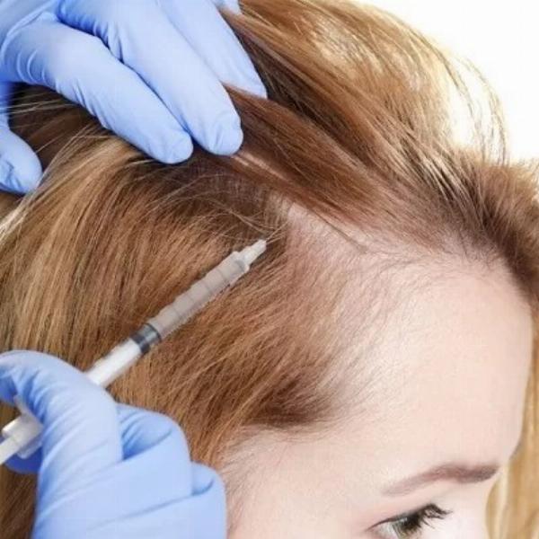 How Much Does PRP Hair Treatment Cost? A Practical Pricing Guide