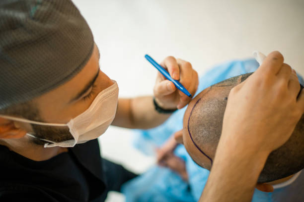 Abu Dhabi Hair Transplant Guide: Procedures, Clinics, and Recovery