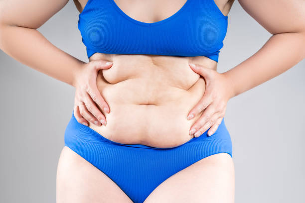 Tummy Tuck in Riyadh: Cost, Clinics, Recovery & Decision Checklist