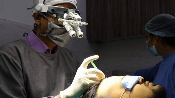 Synthetic Hair Transplants: A Clear Guide to Benefits, Risks, and Safety