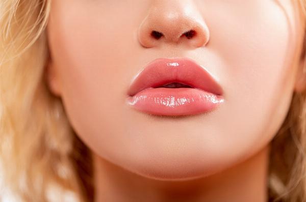 5 Common Russian Lip Fillers Mistakes to Avoid in Dubai