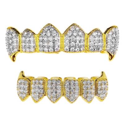 Why Dubai Loves Gold Teeth: Culture, Cost, and Care