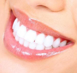 Choosing Teeth Whitening in Dubai: A Clear Guide to Methods, Costs, and Safety