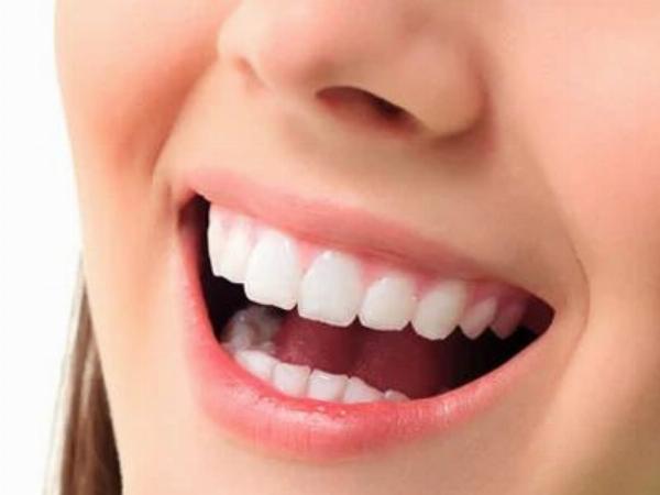 Cosmetic Dentistry in Dubai: A Practical Guide to Achieving a Balanced, Natural Smile