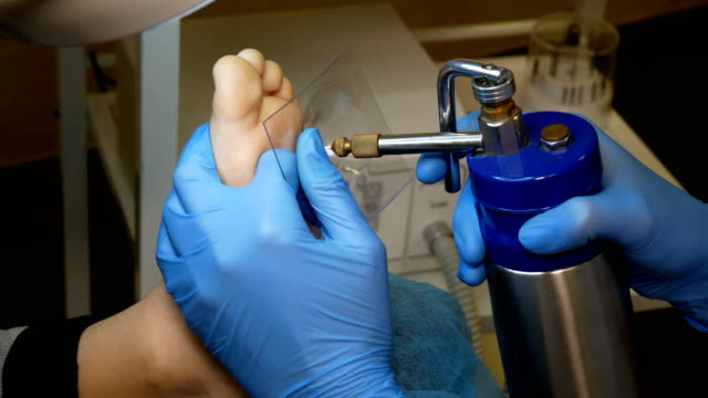 Mole Mapping in Dubai: Early Detection and Preventive Skin Care Strategies