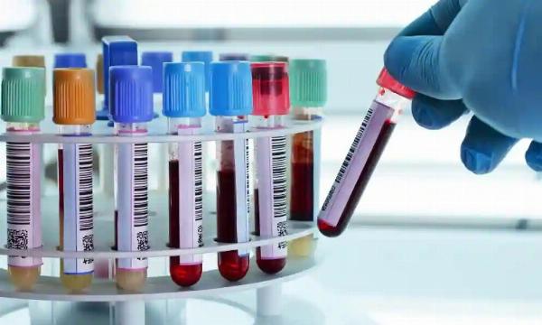 Comprehensive Guide to DNA Testing in Dubai: Types, Process, and Regulations