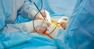 Best Ways to Finance Laparoscopic Surgery in Dubai: Options, Costs, and Checklist
