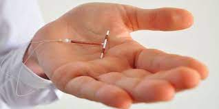 Mirena IUD Cost in Dubai vs Global Markets: Clear Price Comparison & Decision Checklist