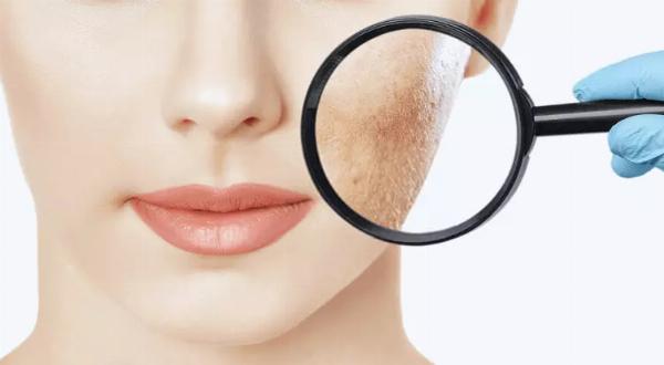 Maximizing Results of Facial Scar Revision in Dubai: Before-and-After Planning and Care
