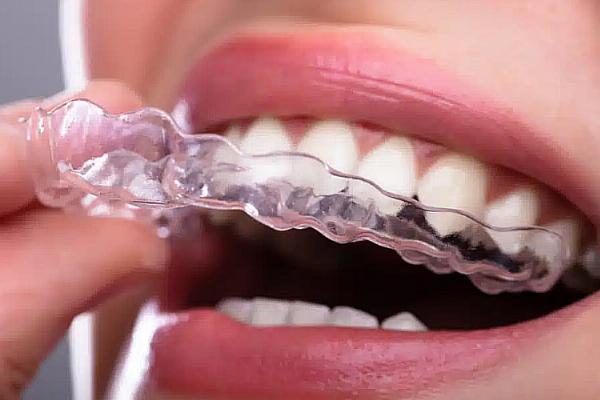 Tooth Removal in Dubai: Common Causes, Procedures, and Recovery
