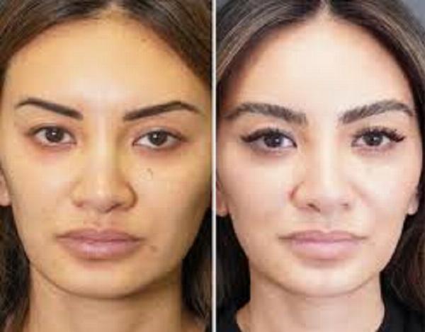 When to Safely Resume Tinting After an Allergic Reaction: A Practical Guide