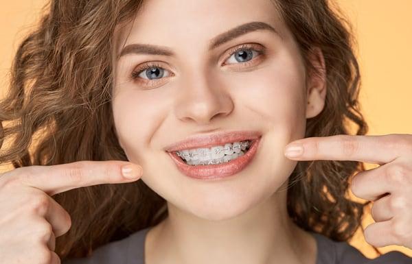 Dubai Braces Price Comparison: How to Find the Best Value for Orthodontic Care