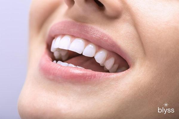 Brighten Your Smile: A Practical Guide to Professional Teeth Whitening in Dubai