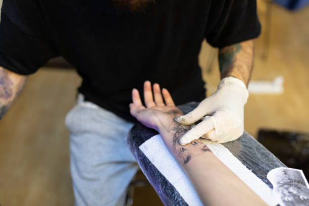 Tattoo Removal Options in Riyadh: Methods, Costs, Clinics, and Aftercare