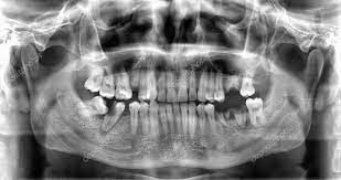 How to Budget for Panoramic Dental X-Rays in Dubai: Cost Guide and Practical Tips