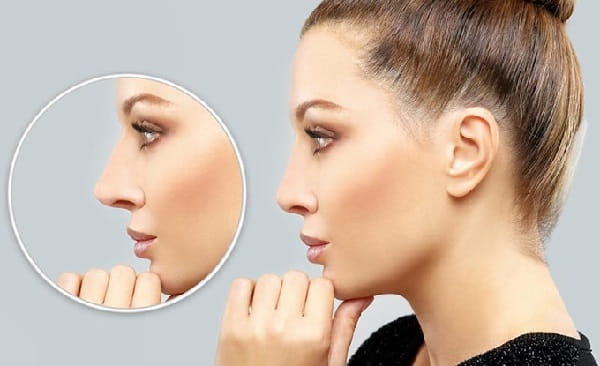 Rhinoplasty in Riyadh: Complete Guide to Results, Costs & Choosing a Surgeon