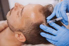PRP Therapy Cost in Dubai: Financing Options and Practical Guide