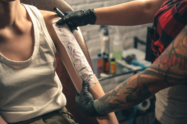 Best Laser Tattoo Removal in Riyadh: Clinics, Methods, and Safety Guide
