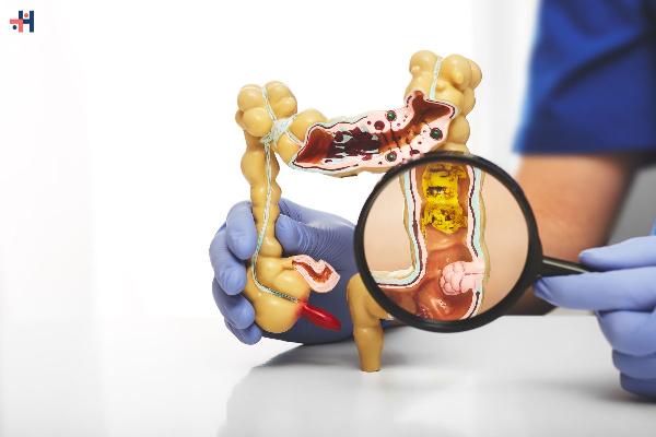 Why People Use Colonic Hydrotherapy: Causes, Risks, and Evidence