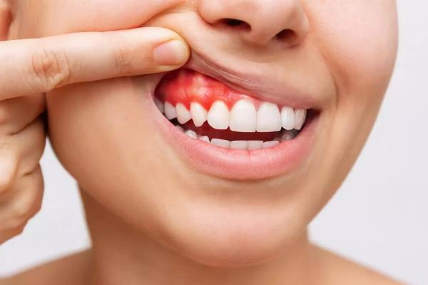 Dubai Full Mouth Implant Cost: Complete Price Guide and What Impacts the Total