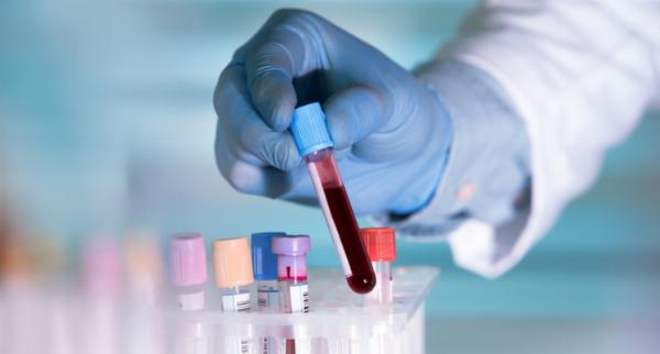 Home Blood Testing in Dubai: Complete At-Home Body Analysis Guide