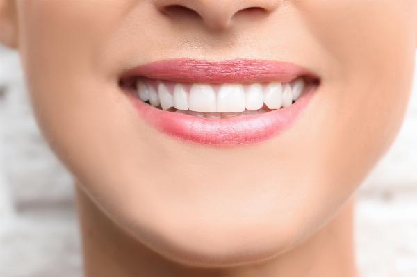 Digital Smile Design Dubai: A Practical Guide to the Process and Benefits