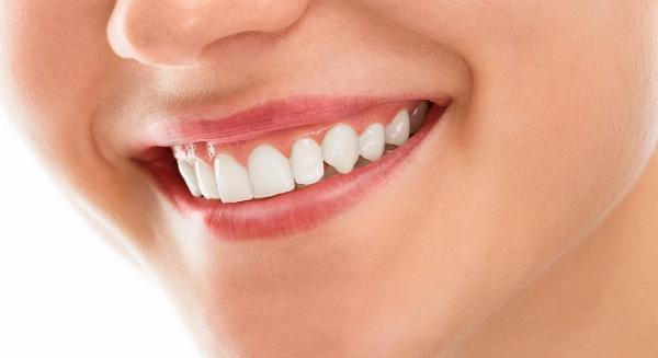 How Digital Smile Design Can Help with Post-Treatment Adjustments in Dubai