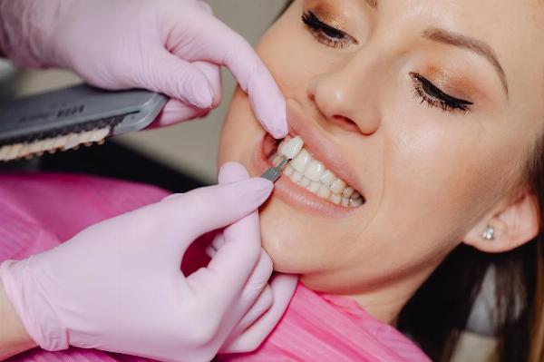 How to Choose the Best Dental Veneers in Dubai: A Practical Guide
