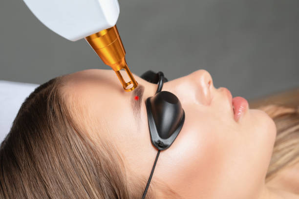 Laser Eye Lift Riyadh: Complete Guide to Non-Surgical Eyelid Rejuvenation