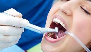 Regular Teeth Cleaning in Dubai: Health Benefits, Frequency, and Local Considerations