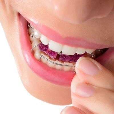 Innovative Dental Appliances: A Practical Guide to Better Oral Health
