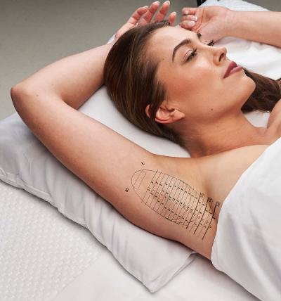 Miradri Treatment Explained: Clear Guide to How It Works, Risks, and Recovery