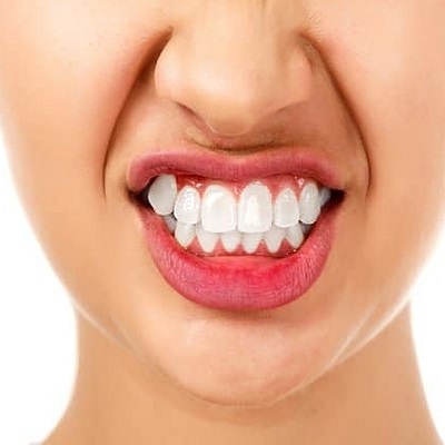 Effective Solutions for Teeth Grinding: Expert Advice from Dubai Dentists
