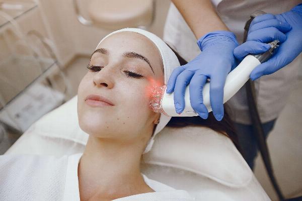 Enhance Your Skin Health with Laser Acne Treatment