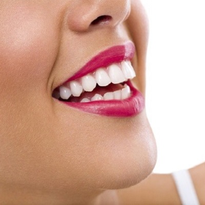 How to Compare Teeth Whitening Products in Dubai: Brands, Safety, and Buying Checklist