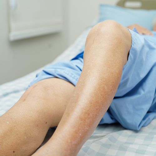 How to Choose the Best Knee Surgeon in London: Criteria, Checklist, and Practical Steps