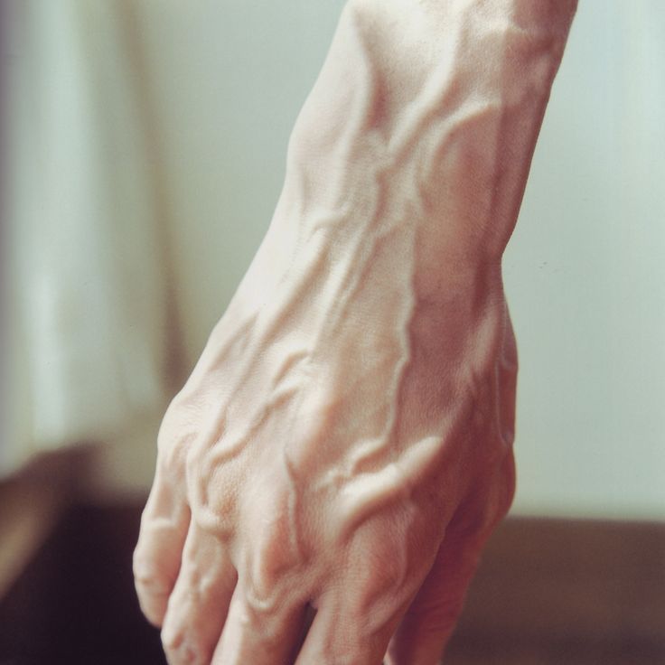 Say Goodbye to Spider Veins: Top Clinics in Riyadh