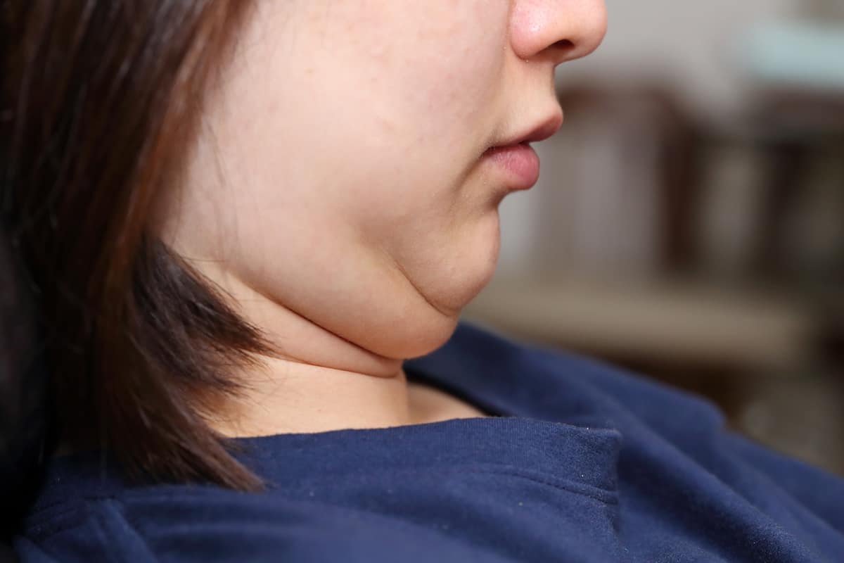 Top-Rated Aesthetic Centers for Double Chin Reduction in Riyadh