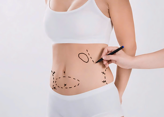 The Best Non-Invasive Treatments: Why Dubai Leads the World in Body Fillers