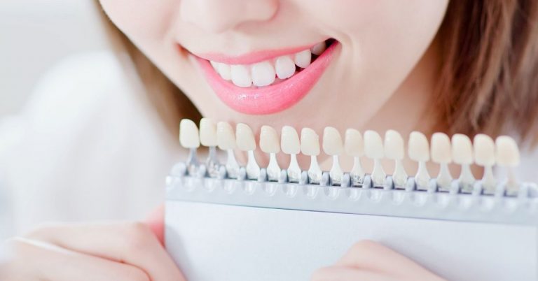 How Composite Veneers in Dubai Can Help Achieve Your Dream Smile
