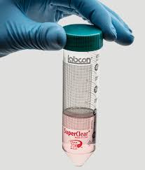 Standard Centrifuge Tube Market Growth Factors 2030