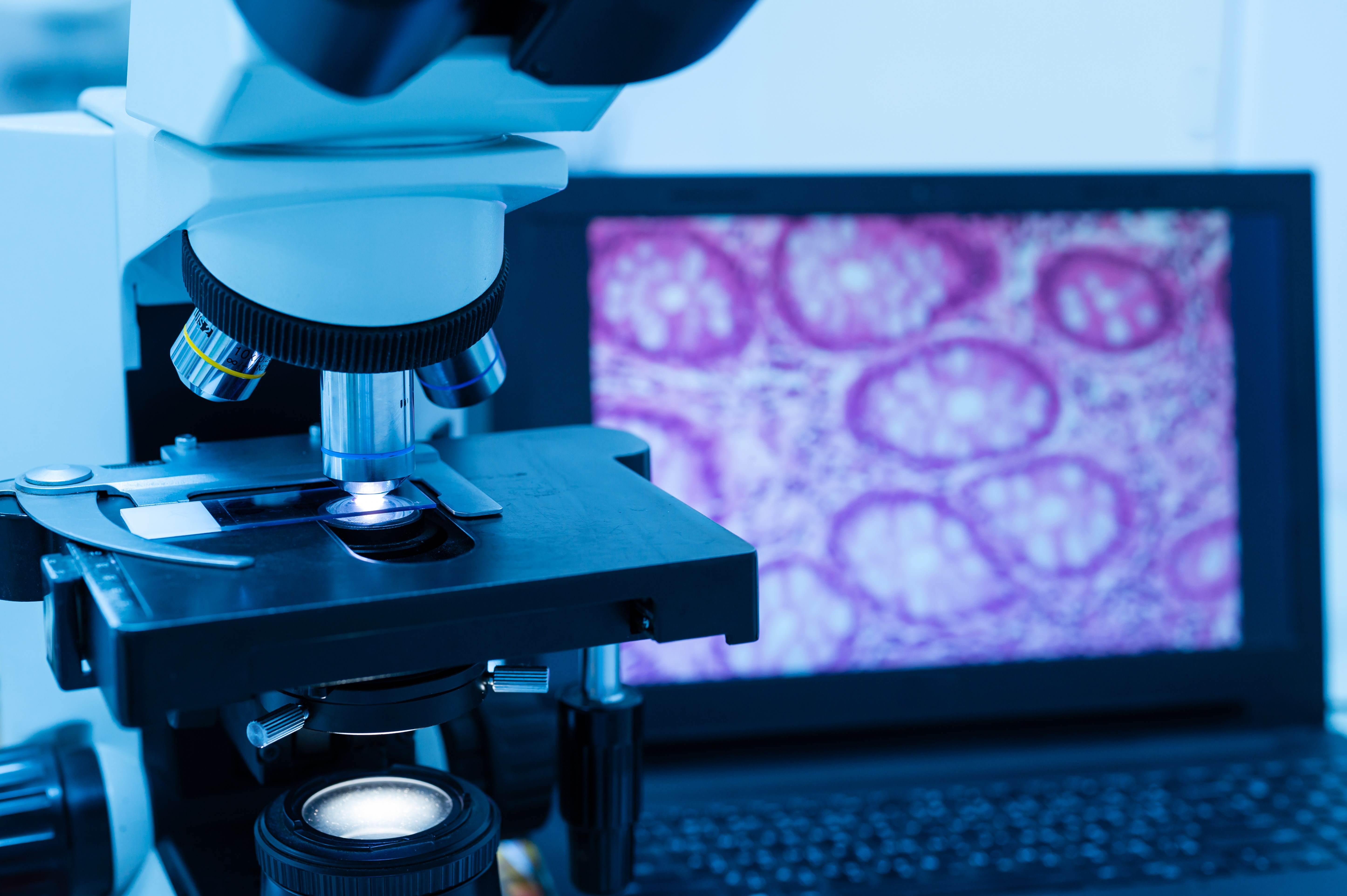 Global Whole Slide Imaging Market, In-depth Insights and Forecast Report 2024-2032