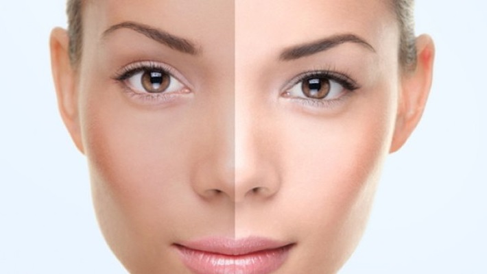 Understanding Permanent Skin Whitening Procedures in Dubai