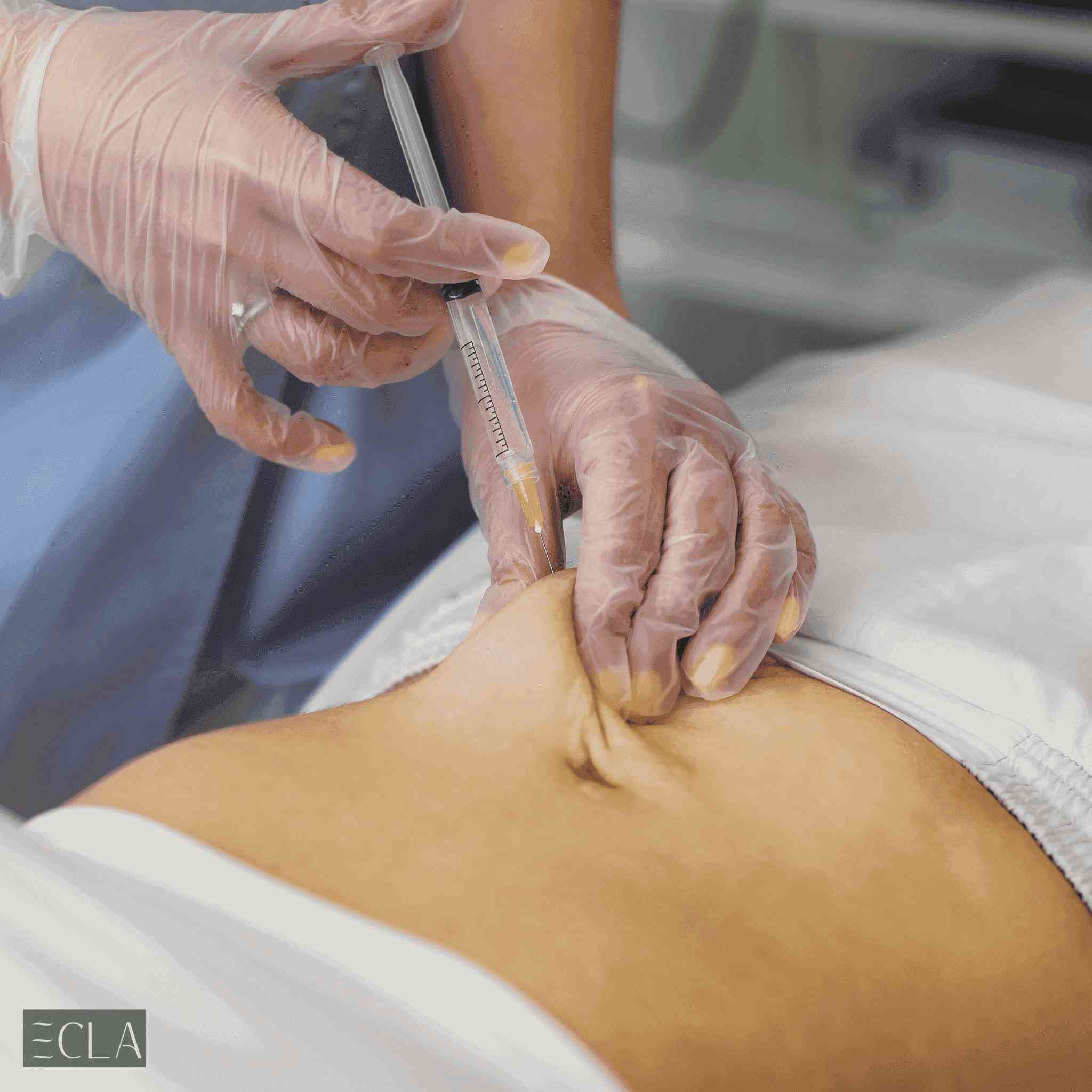 Fat Dissolving Injections vs. Liposuction: Which Suits You?