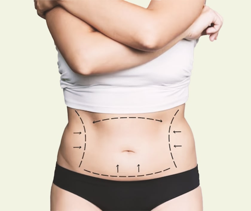 Fat Grafting in Dubai for Subtle, Natural Enhancement