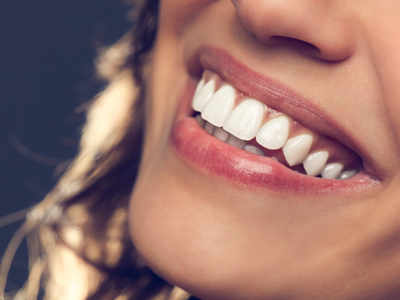 Top Teeth Whitening Treatments Offered in Dubai Clinics